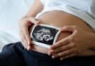 „Înainte să fie un diagnostic, este un copil”. Mărturia unei mame despre fiica ei cu simbrahidactilie