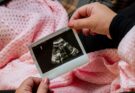 O mamă cu sindrom Turner și copilul pe care aproape l-a avortat din cauza sindromului Turner