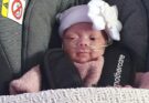 Lilly Rae, fetița născută la 22 de săptămâni care a împlinit șase ani